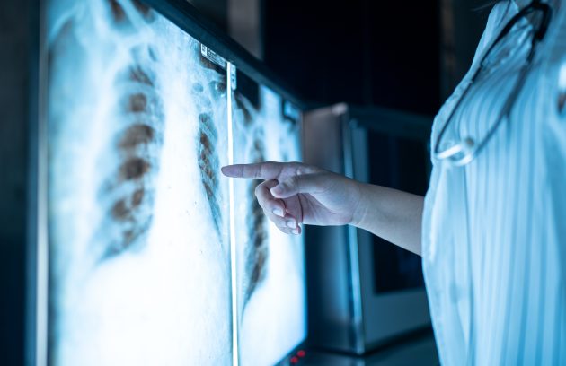 X-ray services at Health Med